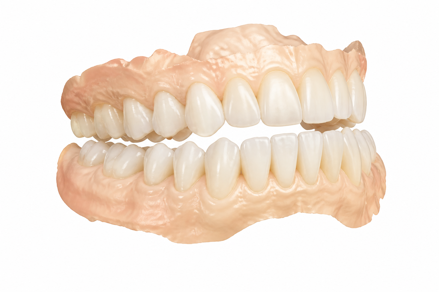Dental scan preview